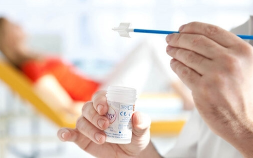 Smear Testi Nedir? Nasıl Yapılır?
