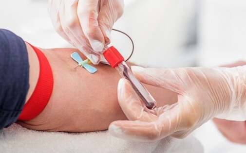 HCT, Hematokrit Yüksekliği, Düşüklüğü